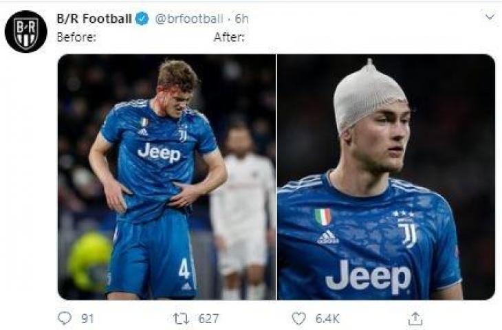 De Ligt mengalami luka di kepala dalam pertandingan Juventus vs Lyon. (Twitter/@brfootball).