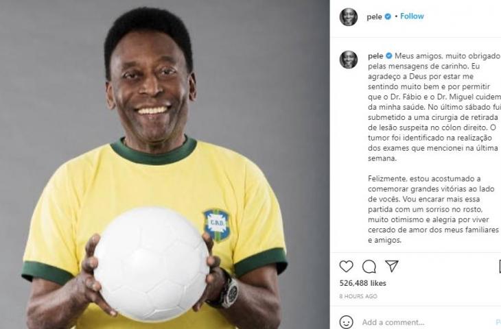 Pele. (Instagram)