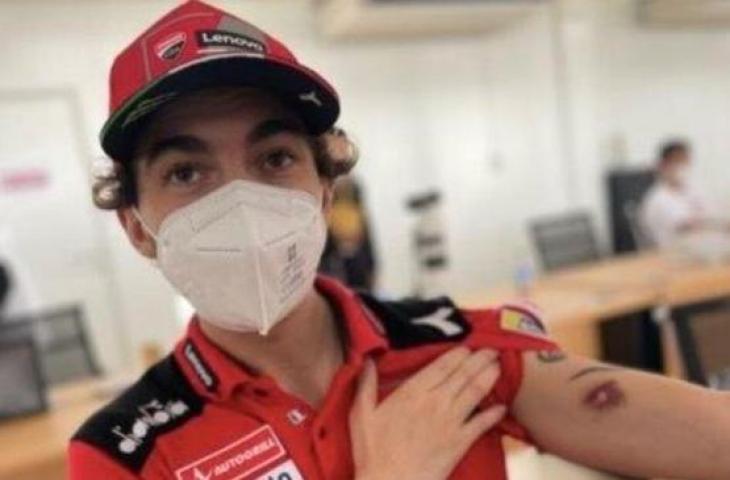 Pebalap Ducati MotoGP, Francesco Bagnaia memperlihatkan luka lebam akibat terkena serpihan batu saat menjalani tes pramusim MotoGP 2022 di Sirkuit Mandalika, 11-13 Februari 2022. [Twitter/@denkmit]