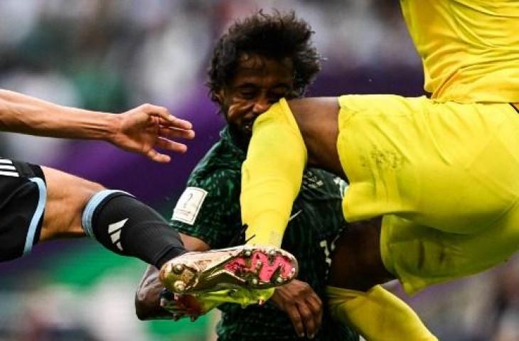 Yasser Al Shahrani alami cedera mengerikan usai kepala kena dengkul kiper Arab Saudi saat kalahkan Argentina di Piala Dunia 2022. (AFP)